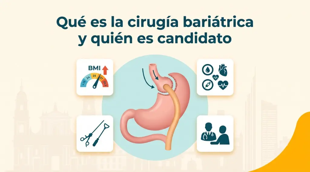 Qué es la cirugía bariátrica y quién es candidato