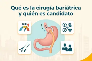 Qué es la cirugía bariátrica y quién es candidato